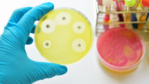 A blue-gloved hand holding a petri dish